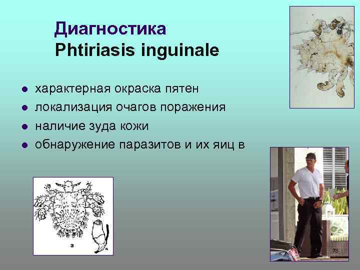 Диагностика Phtiriasis inguinale l l характерная окраска пятен локализация очагов поражения наличие зуда кожи