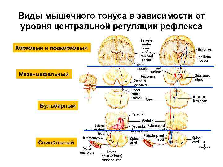 Виды мышечного тонуса в зависимости от уровня центральной регуляции рефлекса Корковый и подкорковый Мезенцефальный