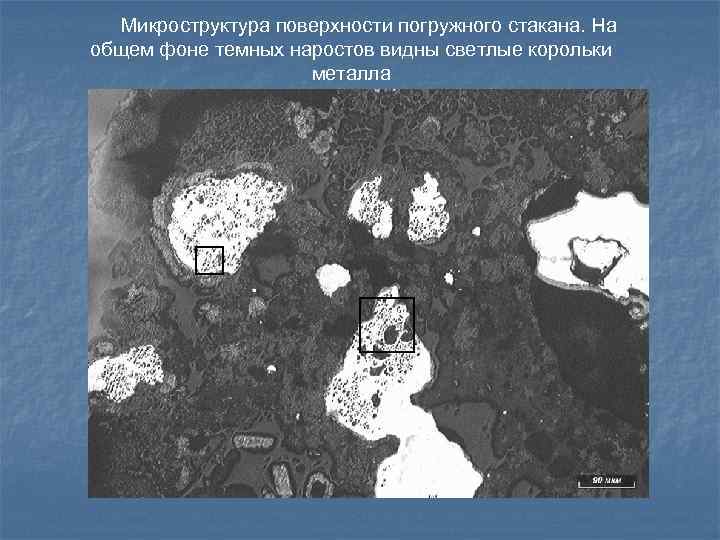 Микроструктура поверхности погружного стакана. На общем фоне темных наростов видны светлые корольки металла 