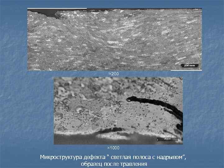 × 200 × 1000 Микроструктура дефекта “ светлая полоса с надрывом”, образец после травления