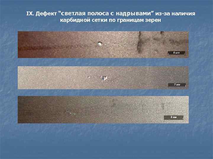 IX. Дефект “светлая полоса с надрывами” из-за наличия карбидной сетки по границам зерен 