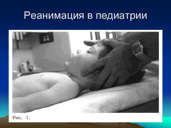 Реанимация в педиатрии 