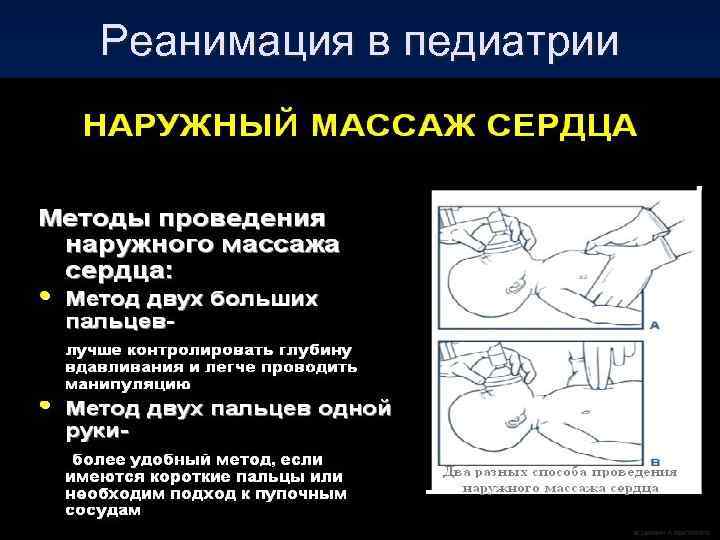Реанимация в педиатрии 