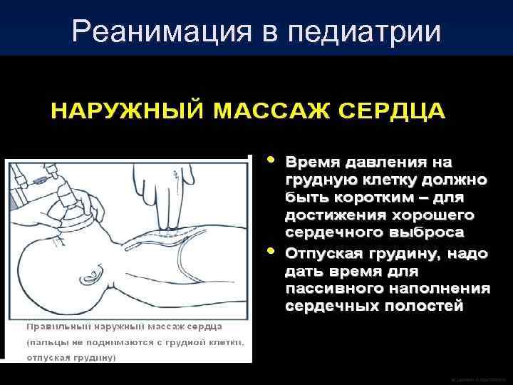 Реанимация в педиатрии 