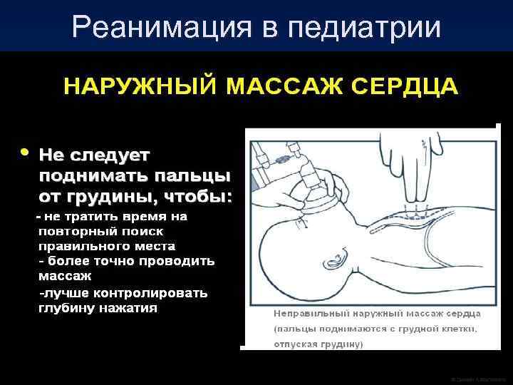 Реанимация в педиатрии 