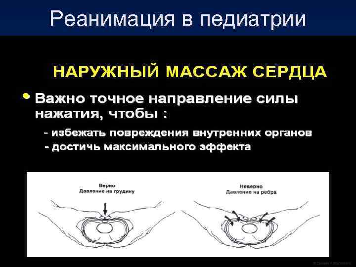 Реанимация в педиатрии 