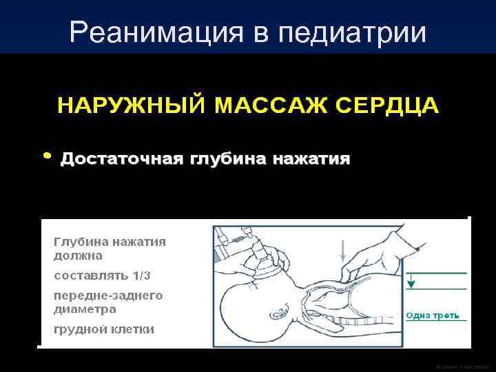 Реанимация в педиатрии 