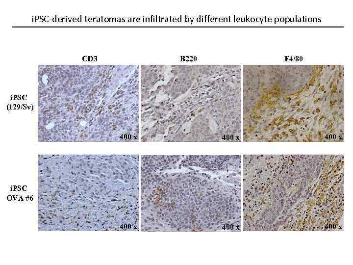 i. PSC-derived teratomas are infiltrated by different leukocyte populations CD 3 B 220 F