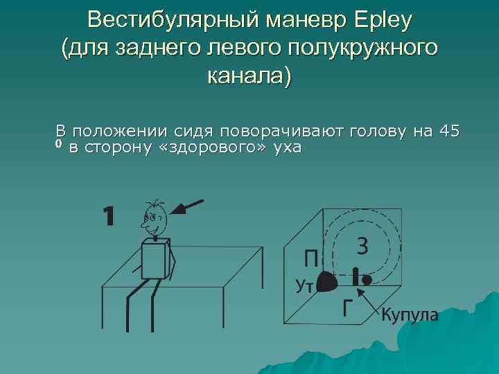 Вестибулярный маневр Epley (для заднего левого полукружного канала) В положении сидя поворачивают голову на