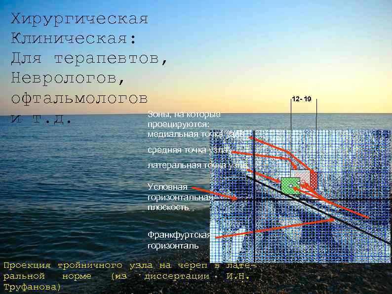 Хирургическая Клиническая: Для терапевтов, Неврологов, офтальмологов Зоны, на которые и т. д. проецируются: медиальная
