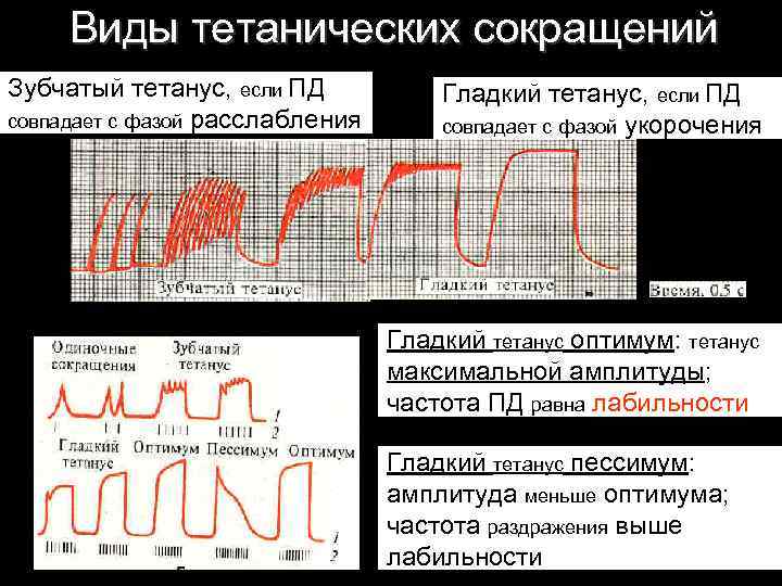 Тетанус это