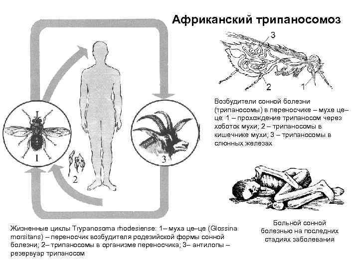 Африканский трипаносомоз Возбудители сонной болезни (трипаносомы) в переносчике – мухе це– це: 1 –