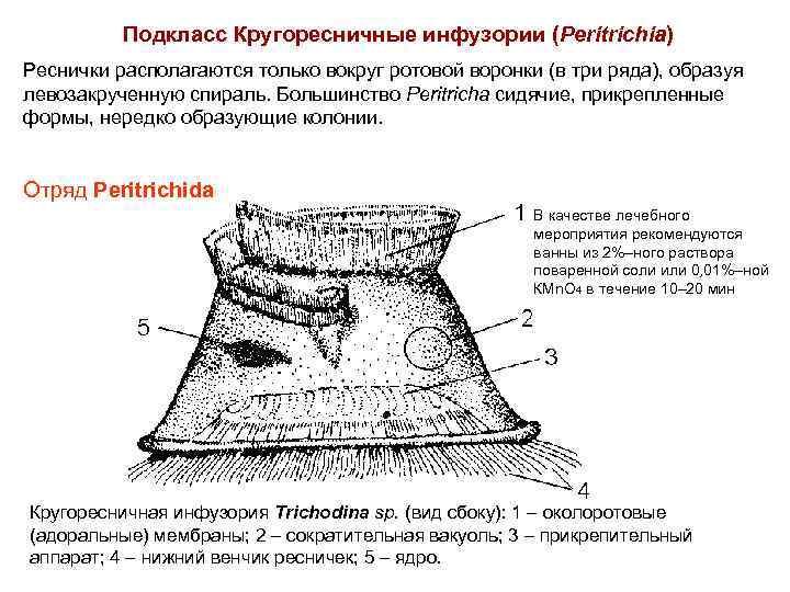 Подкласс Кругоресничные инфузории (Peritrichia) Реснички располагаются только вокруг ротовой воронки (в три ряда), образуя