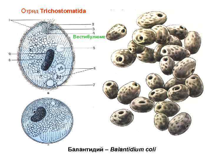 Отряд Trichostomatida Вестибулюме Балантидий – Balantidium coli 