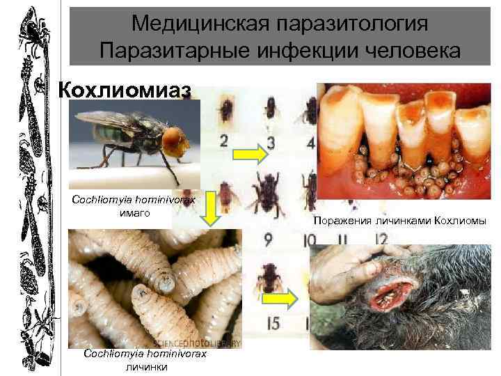 Медицинская паразитология Паразитарные инфекции человека Кохлиомиаз Cochliomyia hominivorax имаго Cochliomyia hominivorax личинки Поражения личинками
