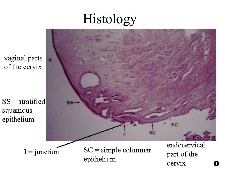 Histology vaginal parts of the cervix SS = stratified squamous epithelium J = junction