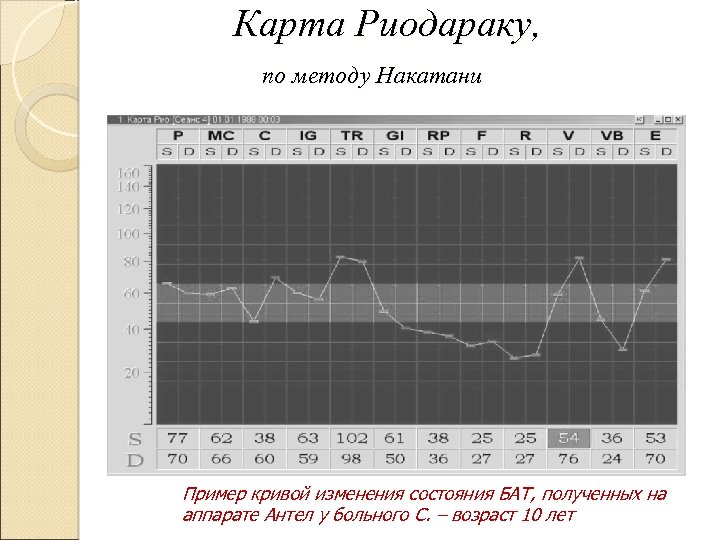 Карта Риодараку, по методу Накатани Пример кривой изменения состояния БАТ, полученных на аппарате Антел