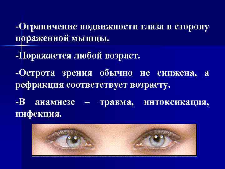 -Ограничение подвижности глаза в сторону пораженной мышцы. -Поражается любой возраст. -Острота зрения обычно не