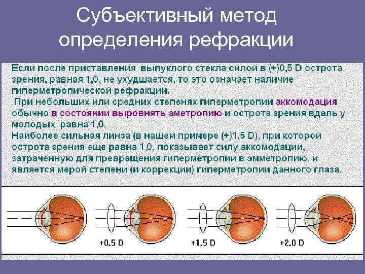 Рефракция и аккомодация глаза офтальмология презентация