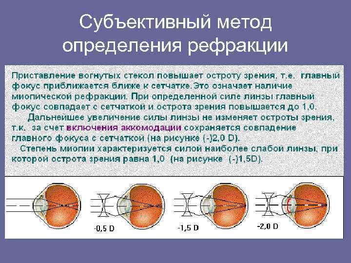 Задней вершинной рефракции. Методов исследования клинической рефракции глаза. Субъективный метод исследования рефракции. Объективные методы исследования рефракции глаза. Методы определения клинической рефракции.