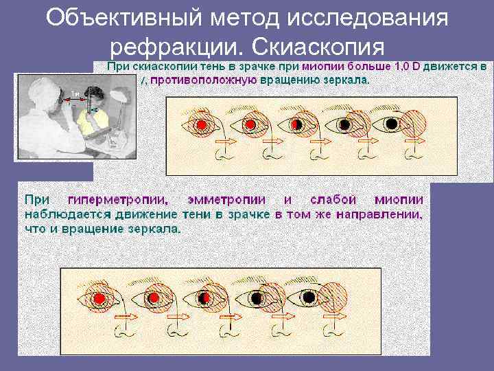 Объективный метод исследования рефракции. Скиаскопия 