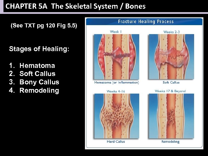 CHAPTER 5 A The Skeletal System / Bones (See TXT pg 120 Fig 5.