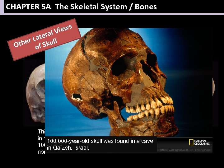 CHAPTER 5 A The Skeletal System / Bones iews V eral r Lat kull