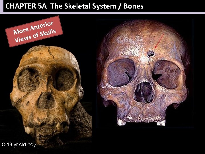 CHAPTER 5 A The Skeletal System / Bones r nterio ore A Skulls M