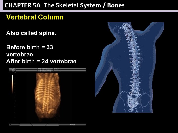 CHAPTER 5 A The Skeletal System / Bones Vertebral Column Also called spine. Before
