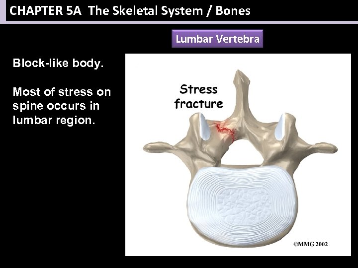 CHAPTER 5 A The Skeletal System / Bones Lumbar Vertebra Block-like body. Most of
