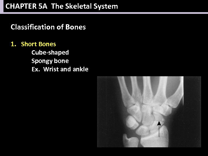 CHAPTER 5 A The Skeletal System Classification of Bones 1. Short Bones Cube-shaped Spongy