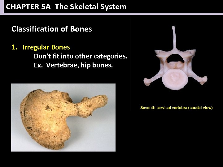 CHAPTER 5 A The Skeletal System Classification of Bones 1. Irregular Bones Don’t fit
