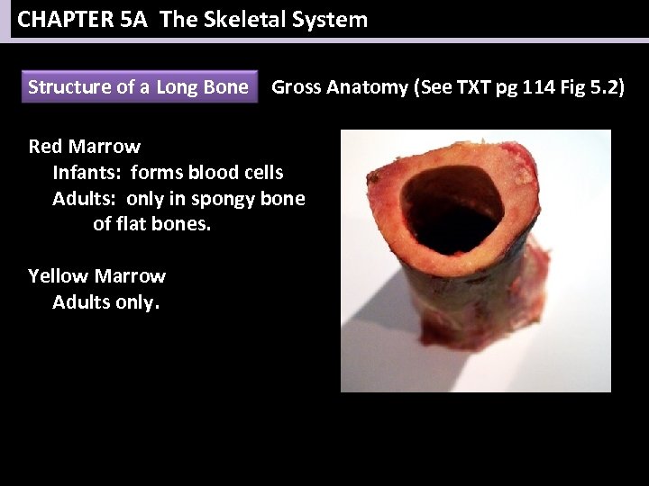CHAPTER 5 A The Skeletal System Structure of a Long Bone Gross Anatomy (See