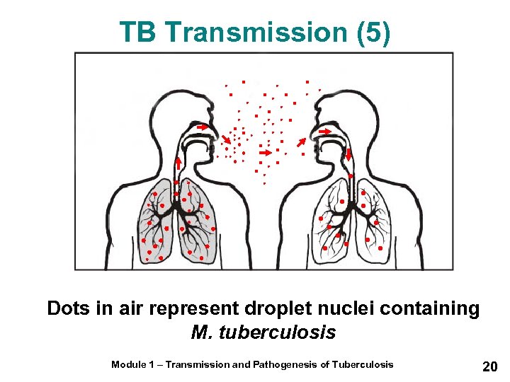 TB Transmission (5) Dots in air represent droplet nuclei containing M. tuberculosis Module 1