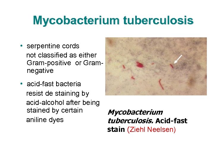 Mycobacterium tuberculosis • serpentine cords not classified as either Gram-positive or Gramnegative • acid-fast