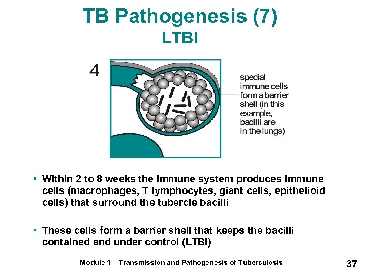 TB Pathogenesis (7) LTBI • Within 2 to 8 weeks the immune system produces