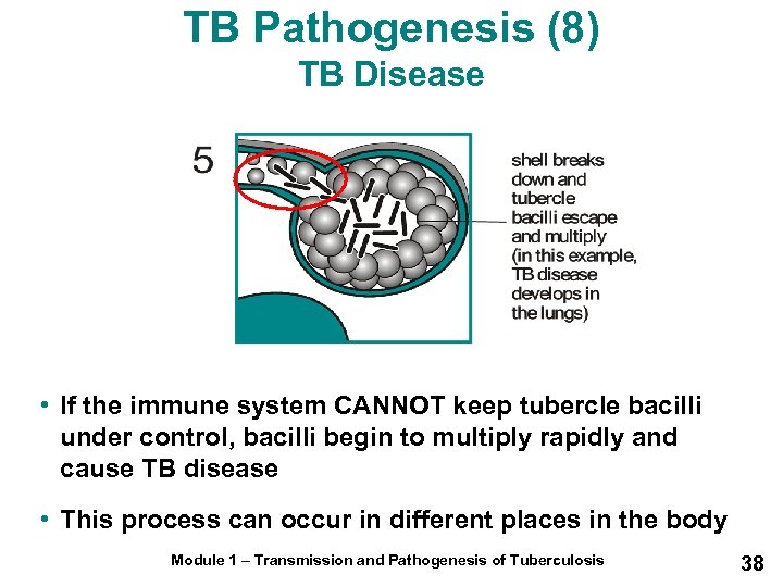 TB Pathogenesis (8) TB Disease • If the immune system CANNOT keep tubercle bacilli