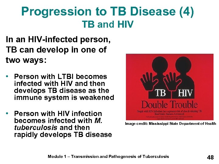 Progression to TB Disease (4) TB and HIV In an HIV-infected person, TB can