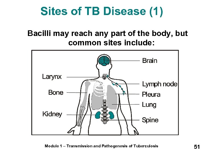 Sites of TB Disease (1) Bacilli may reach any part of the body, but