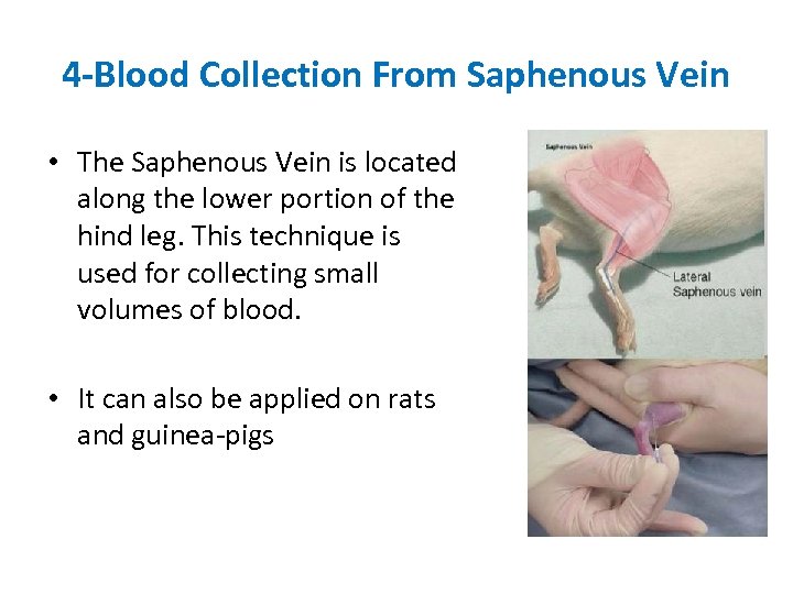4 -Blood Collection From Saphenous Vein • The Saphenous Vein is located along the