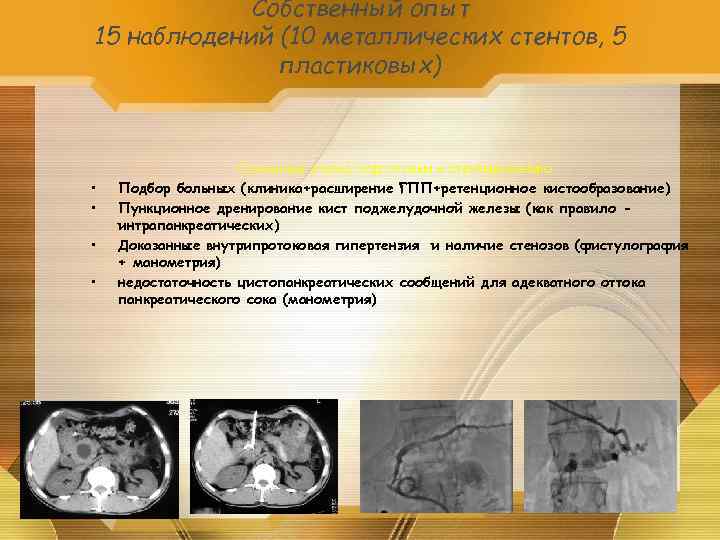 Собственный опыт 15 наблюдений (10 металлических стентов, 5 пластиковых) • • Основные этапы подготовки