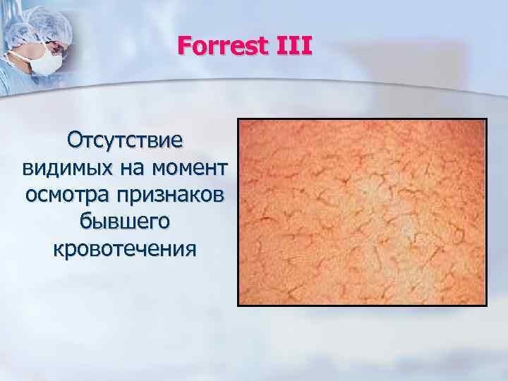 Forrest III Отсутствие видимых на момент осмотра признаков бывшего кровотечения 