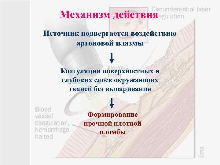 Механизм действия Источник подвергается воздействию аргоновой плазмы Коагуляция поверхностных и глубоких слоев окружающих тканей