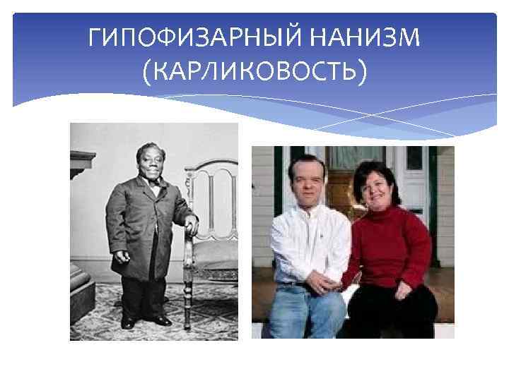 ГИПОФИЗАРНЫЙ НАНИЗМ (КАРЛИКОВОСТЬ) 
