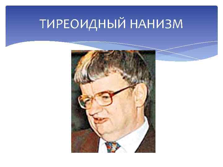 ТИРЕОИДНЫЙ НАНИЗМ 