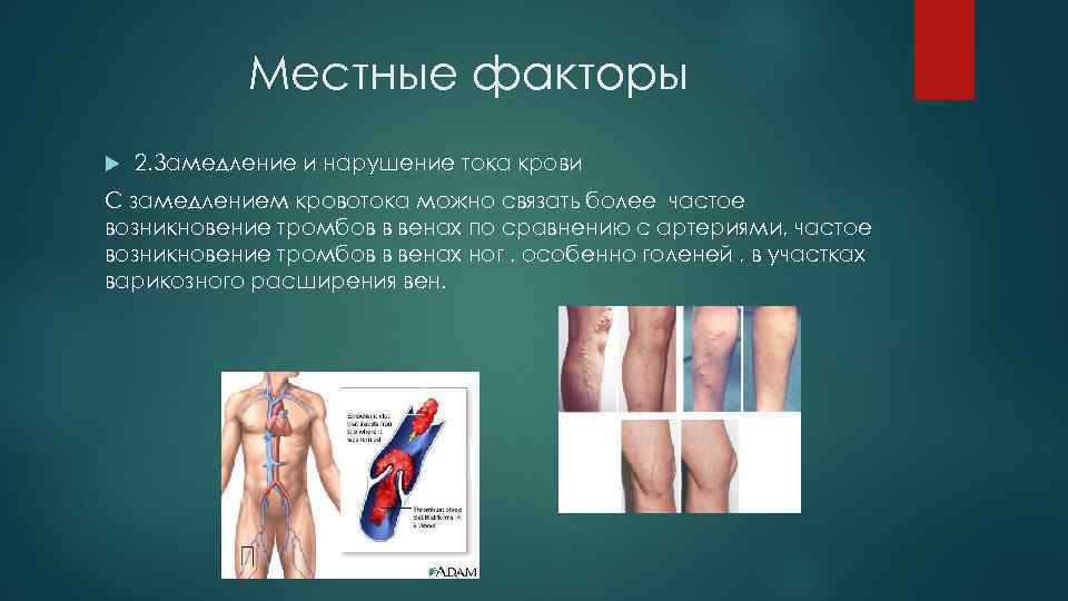 Местные факторы 2. Замедление и нарушение тока крови С замедлением кровотока можно связать более