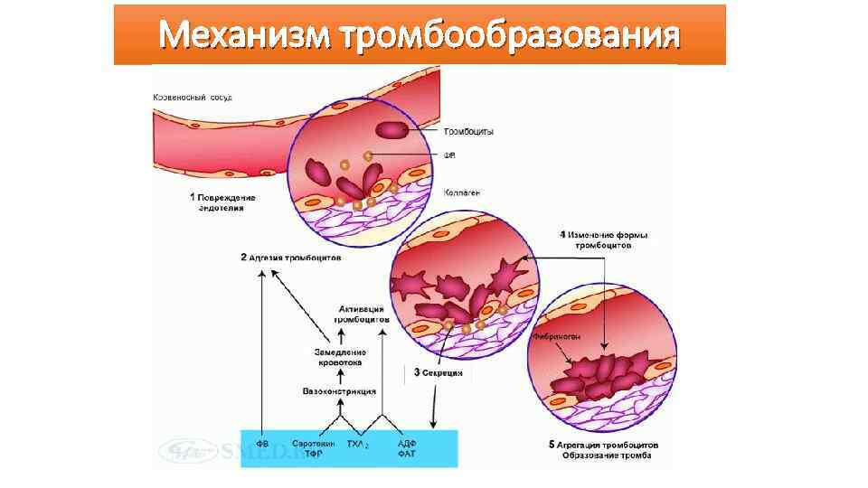Механизм тромбообразования 