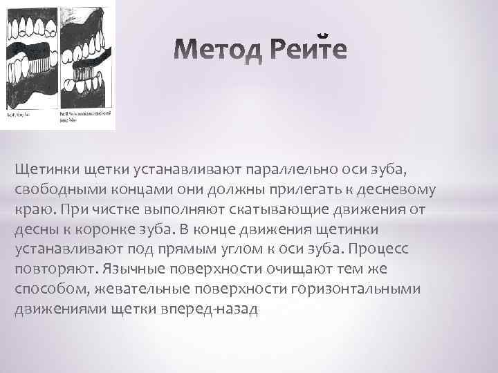  Щетинки щетки устанавливают параллельно оси зуба, свободными концами они должны прилегать к десневому