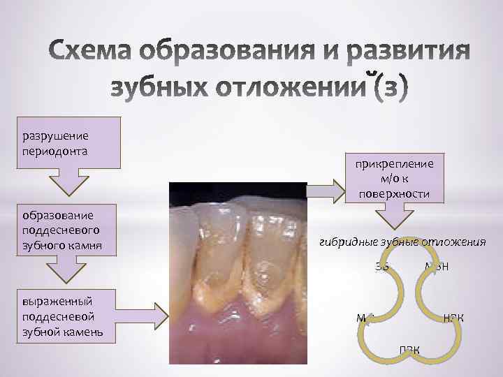  разрушение периодонта образование поддесневого зубного камня прикрепление м/о к поверхности гибридные зубные отложения