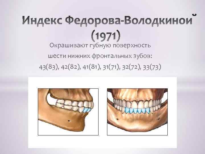 Окрашивают губную поверхность шести нижних фронтальных зубов: 43(83), 42(82), 41(81), 31(71), 32(72), 33(73) 